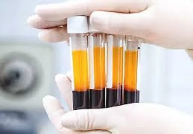 করোনা চিকিৎসায় ঢামেকে প্লাজমা সংগ্রহ শুরু