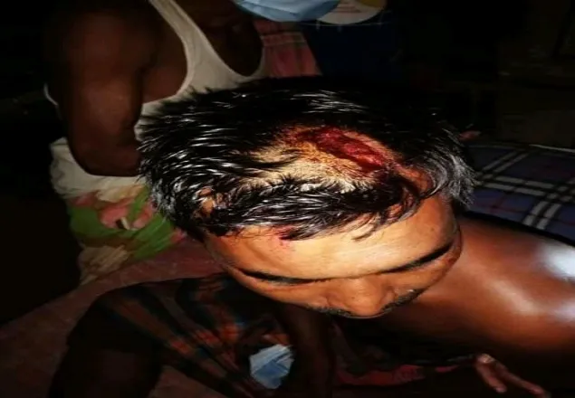 মাগুরায় পূর্বশুত্রুতার জেরে হামলা, আহত ৪ বাড়িঘর ভাংচুর