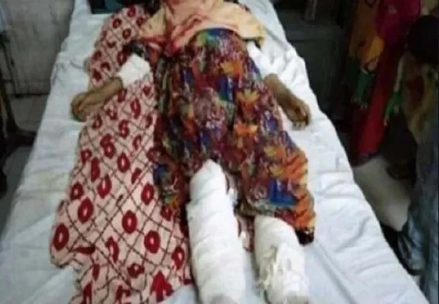 স্বামীর পিটুনিতে চার হাত-পা ভাঙা সেই অন্তঃসত্ত্বা নারীর মৃত্যু