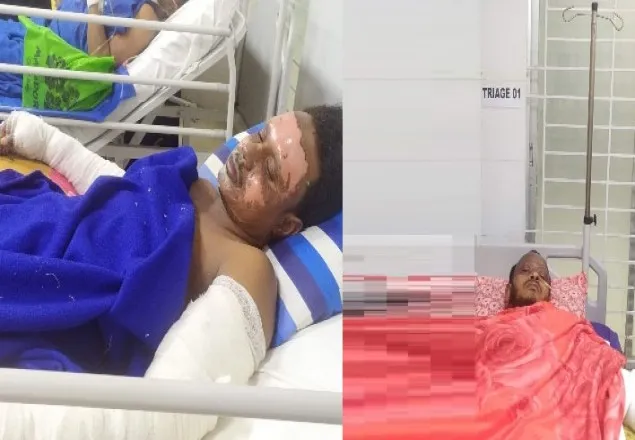 পান্থপথে বিস্ফোরণ, তিতাসের ৩ কর্মীসহ দগ্ধ ৪