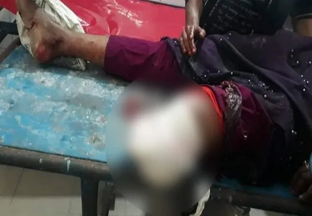 লঞ্চের ধাক্কায় দাঁড়িয়ে থাকা যাত্রীর পা বিচ্ছিন্ন