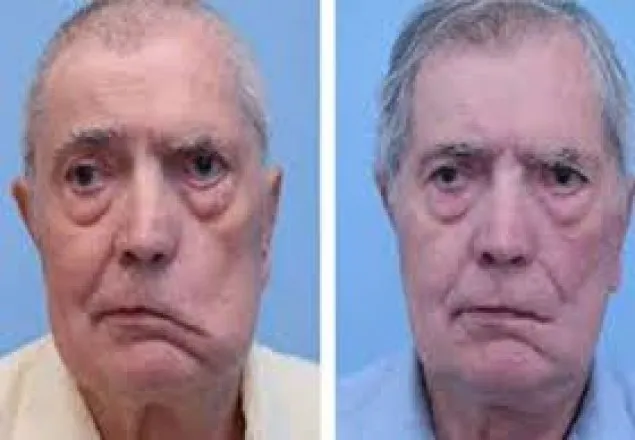 ইসরাইলে ভ্যাকসিন নিয়ে ১৩ জনের মুখমণ্ডল বিকৃত