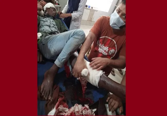 সোনাইমুড়ী পৌর নির্বাচনে বোমা বিস্ফোরণ, গুলিবিদ্ধ ১