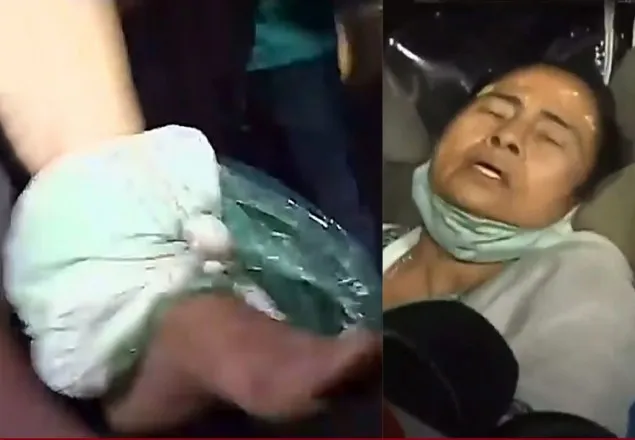 ৪-৫ জনের ধাক্কা, পড়ে গিয়ে পা ও মাথায় চোট মমতার
