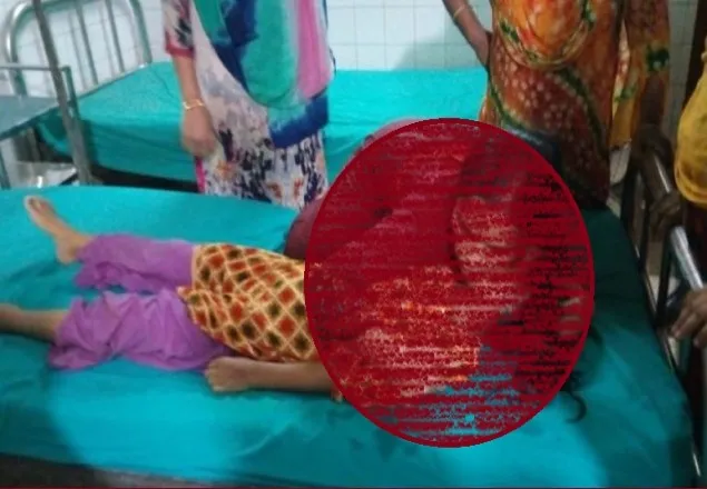 মালিবাগে বৃষ্টির সময় বিদ্যুৎস্পৃষ্টে ৩ জনের মৃত্যু