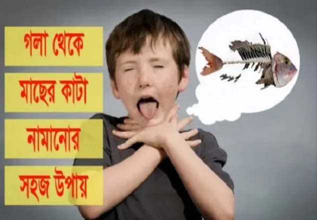 গলা থেকে মাছের কাঁটা নামানোর সহজ উপায়
