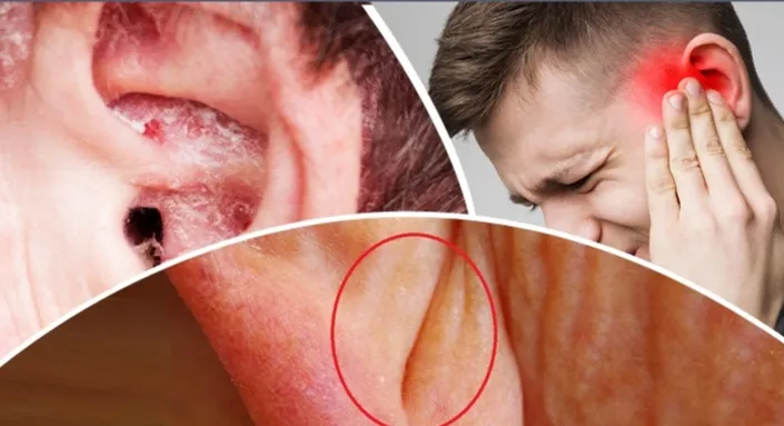 কানের যেসব সমস্যা গুরুতর রোগের ইঙ্গিত দেয়