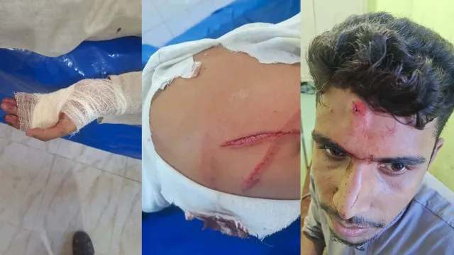 গোবিন্দগঞ্জ ছাত্রশিবিরের উপর ছাত্রদলের হামলা