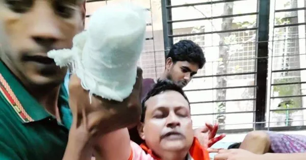 কুপিয়ে কলেজশিক্ষকের কবজি বিচ্ছিন্ন করল দুর্বৃত্তরা