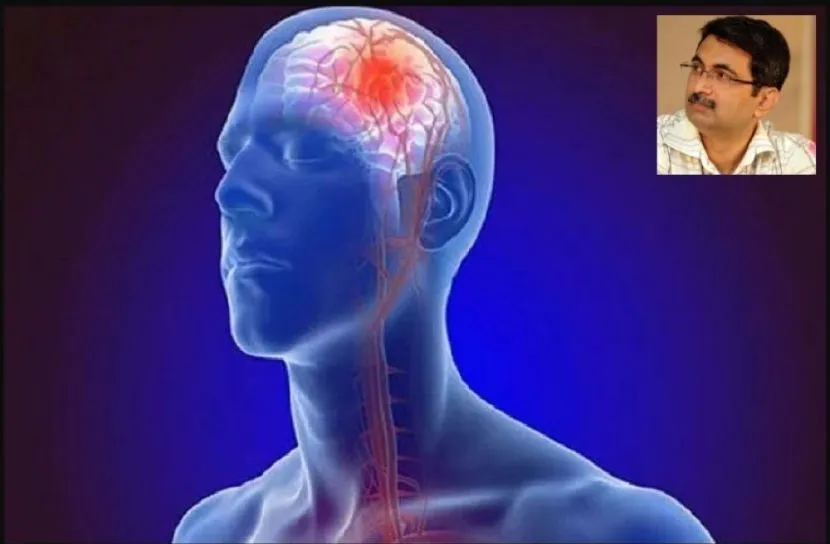 স্ট্রোকের লক্ষণ জানুন, বাঁচিয়ে দিন বহু জীবন