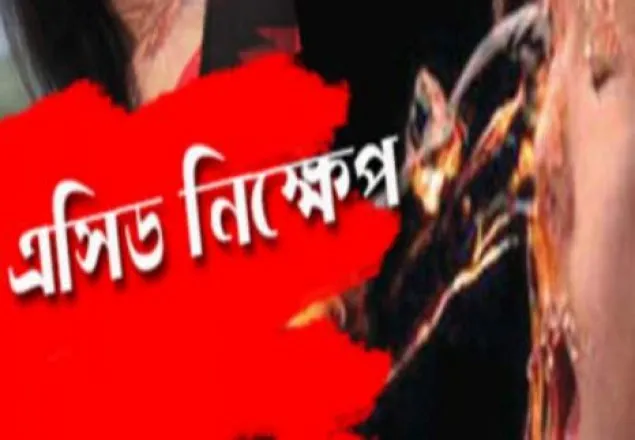 কেরানীগঞ্জে এসিডে ঝলসে গেলো শিশু