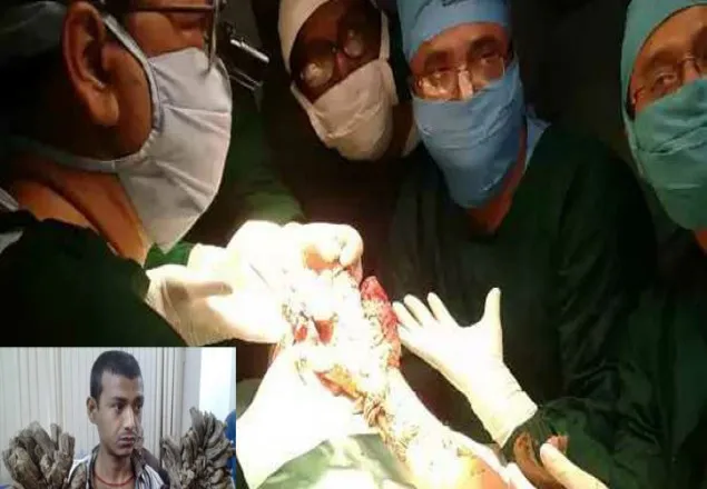 ৫ আঙুলেই অস্ত্রোপচার, সুস্থ আছেন বৃক্ষমানব
