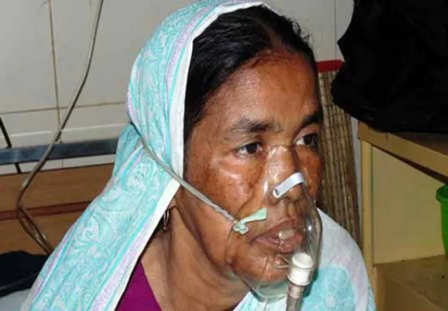 অর্থের অভাবে চিকিৎসা ব্যাহত বীর বিক্রম তারামন বিবির