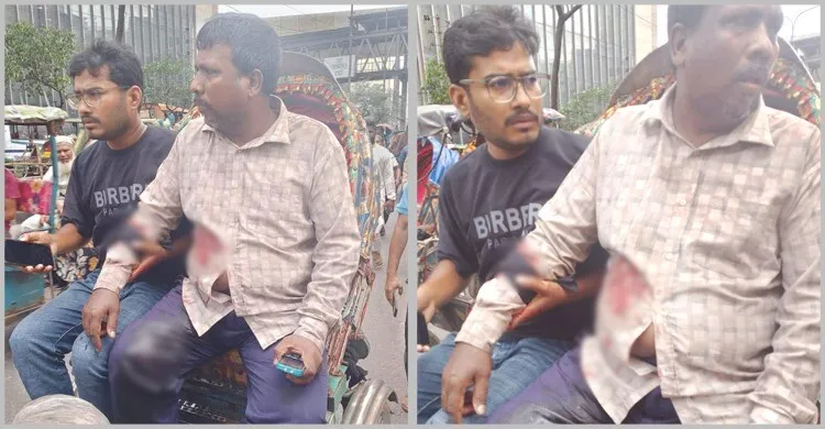 মতিঝিলে প্রকাশ্যে ব্যবসায়ীকে গুলি করে ১৭ হাজার ডলার লুট