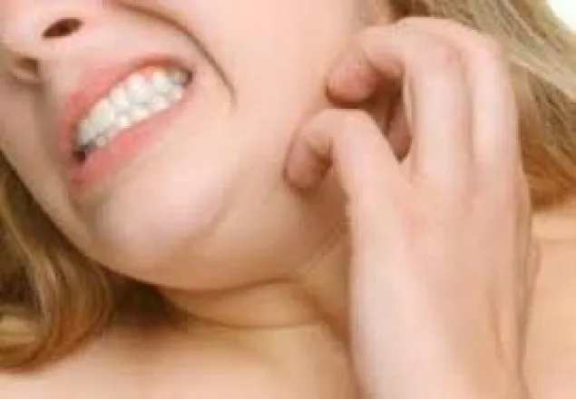 চর্মরোগ প্রতিরোধে করণীয়