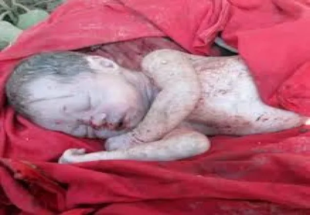 রাজধানীর পৃথক স্থানে ২ নবজাতকের লাশ উদ্ধার