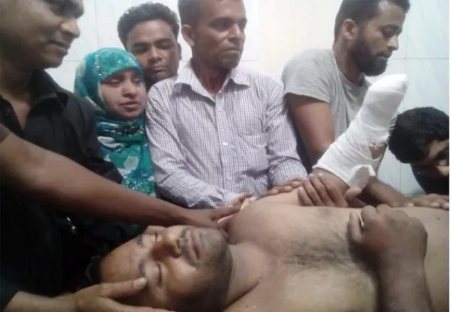 মেম্বার প্রার্থীর হাতের কব্জি কেটে নিয়ে আওয়ামী লীগের উল্লাস