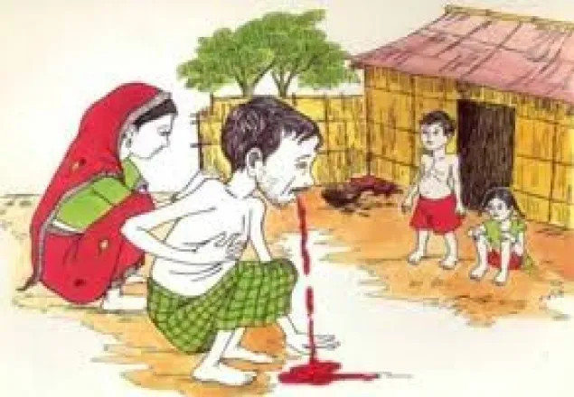২৪ মার্চ বিশ্ব যক্ষ্মা দিবস