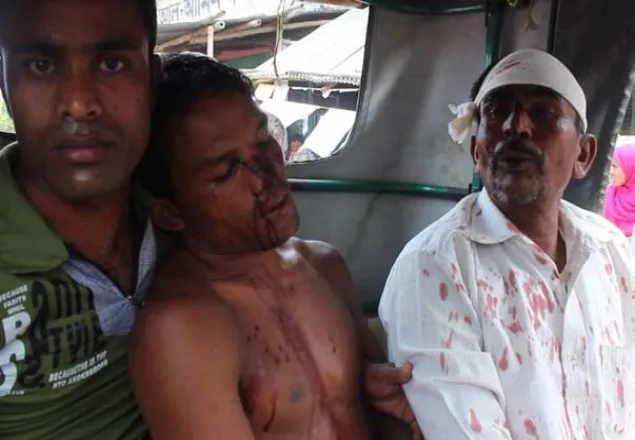ঠাকুরগাঁওয়ে নির্বাচনী সহিংসতায় আহত-১২