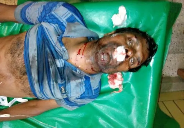 বিরামপুর ইউপি নির্বাচনে পেট্রোল বোমা নিক্ষেপ