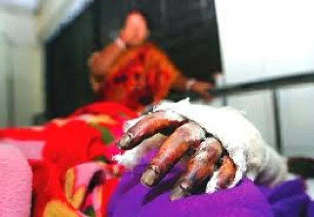 আশুলিয়ায় গ্যাস পাইপ বিস্ফোরণে দগ্ধ ৩