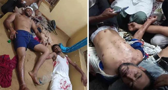 হবিগঞ্জে বিএনপির সমাবেশে পুলিশের মুহুর্মুহু গুলি : অর্ধ শতাধিক নেতাকর্মী আহত