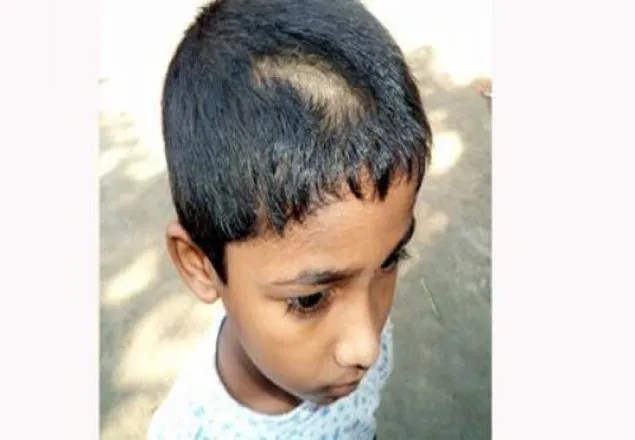 শিশু শিক্ষার্থীর চুল কেটে দিল শিক্ষক