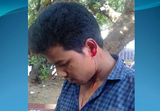 ঢাবিতে সাংবাদিককে পেটাল ছাত্রলীগ