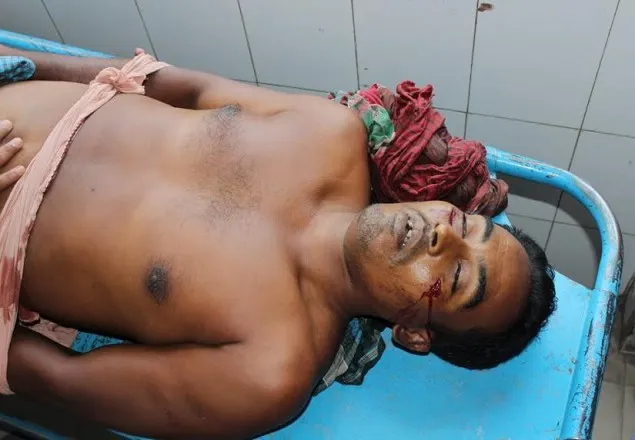 কুষ্টিয়ায় নির্বাচনী সহিংসতায় নিহত ১ আহত ১৫