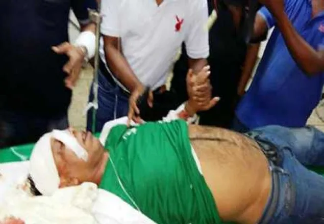 ফেনী প্রেস ক্লাবের সভাপতিসহ ৪ জনকে কুপিয়ে জখম