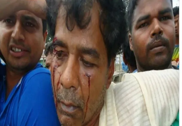গোপালগঞ্জে স্বতন্ত্র চেয়ারম্যান প্রার্থীকে মারধর