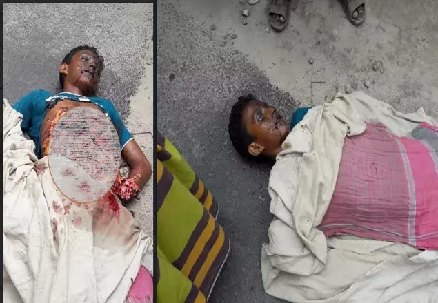 কুষ্টিয়ায় বোমা বিস্ফোরনে স্কুল ছাত্র নিহত