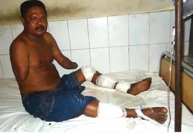 মাদক বিক্রিতে বাধা; দুই হাতের পর গেল দু’পাও
