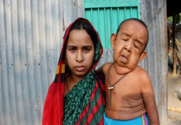 মায়ের কোলে বৃদ্ধ শিশু!