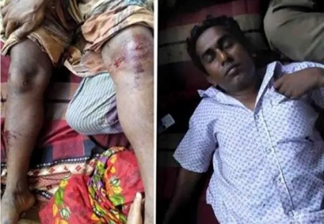 খুলনায় বিদ্রোহী প্রার্থীকে বেঁধে হাতুড়ি দিয়ে পিটিয়ে জখম