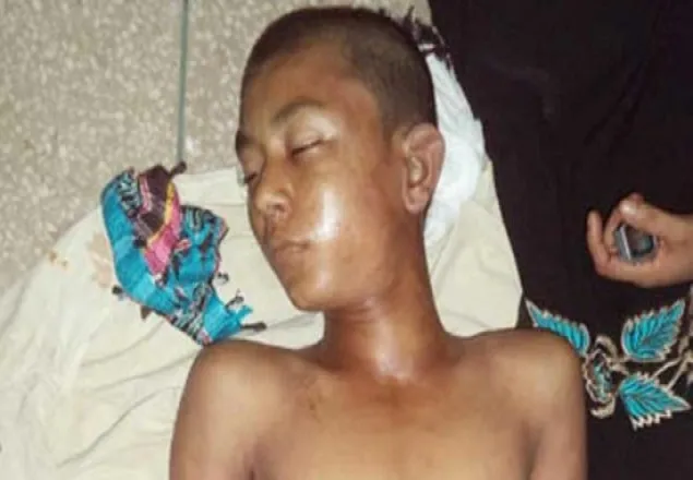চেয়ারম্যানের বিজয় মিছিলে আ'লীগের হামলায় স্কুলছাত্র নিহত 