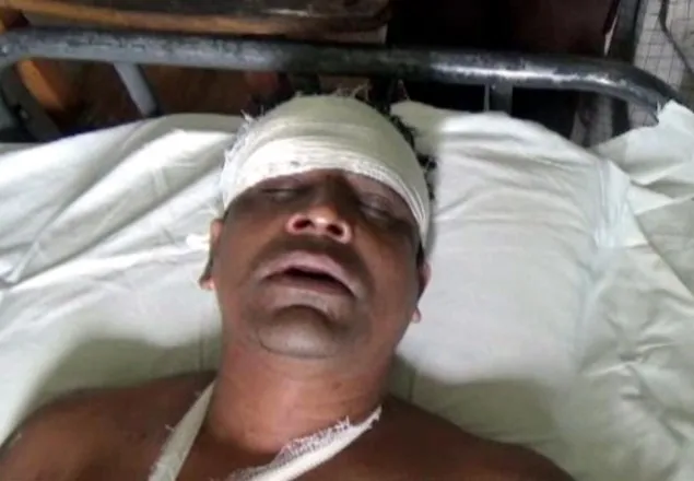 হাতিয়ায় বালিকা বিদ্যালয়ে হামলায় ছাত্রী শিক্ষক’সহ আহত-২০