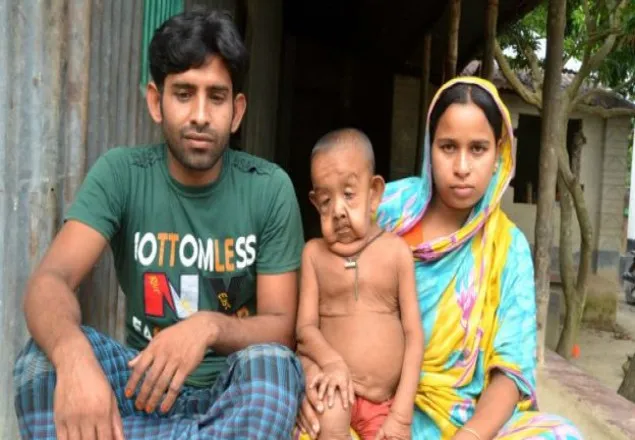 চার বছরের শিশু যখন আশি বছরের বৃদ্ধ !