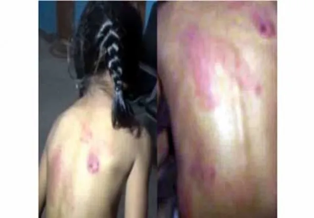 হোমওয়ার্ক না করায় অমানবিক নির্যাতন