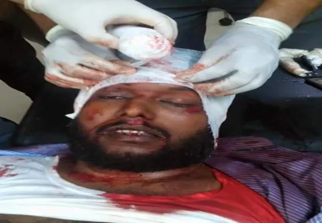 ডা. মোজাম্মেল হকের মৃত্যুতে শিবিরের শোক