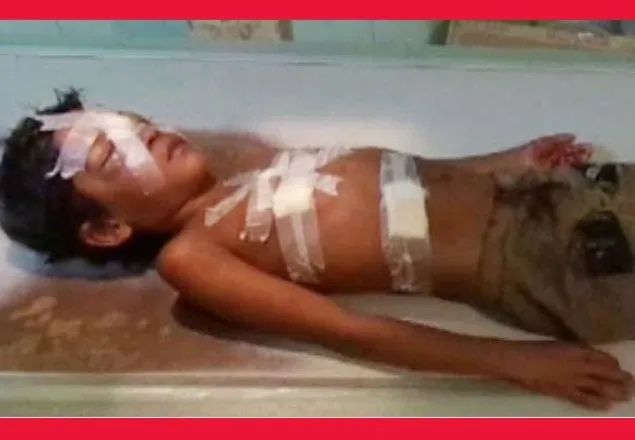 পাবনায় নির্বাচন পরবর্তি সহিংসতায় নিহত ১