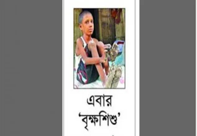 'বৃক্ষশিশু' রিপন ঢামেকের বার্ন ইউনিটে ভর্তি