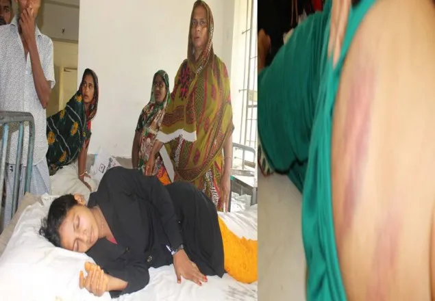 সুবর্ণচরে গ্রাম্যশালিশে স্কুলছাত্রীকে মধ্যযুগীয় কায়দায় নির্যাতন