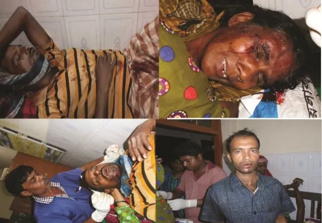 কুষ্টিয়ায় আ.লীগ-জাসদ সংঘর্ষে আহত ২০