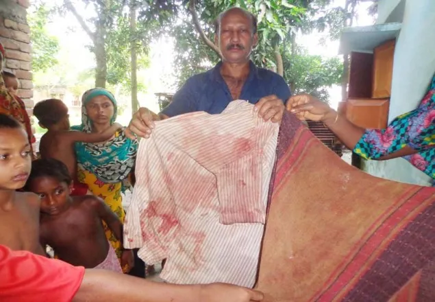 ঝিনাইদহে প্রফেসরকে কুপিয়ে হত্যার চেষ্টা