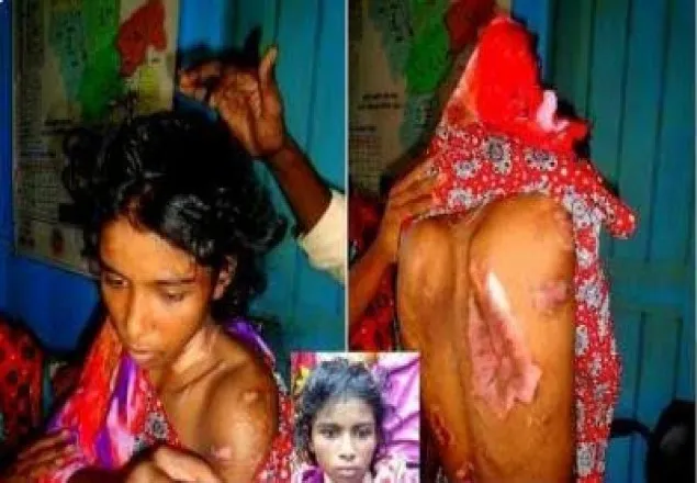 রংপুর মেডিকেলে কাদঁছে গৃহকর্মী আর্জিনা