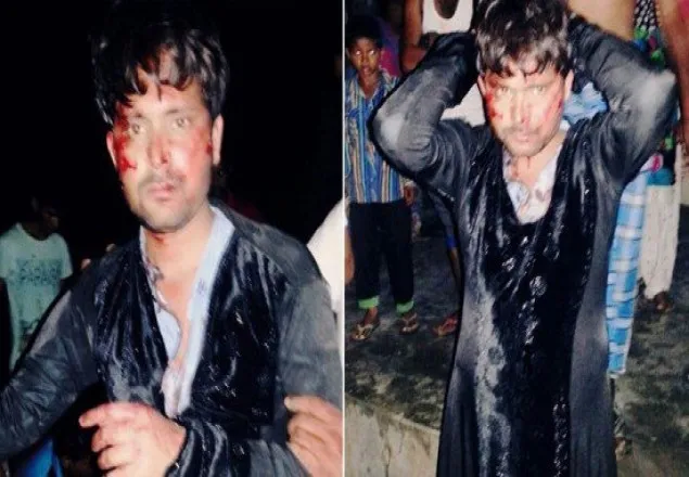 বোরকাকে অবমাননায় হিন্দু নেতাকে গণধোলাই