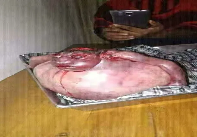 চট্রগ্রামে অদ্ভুদ আকৃতির শিশুর জন্ম