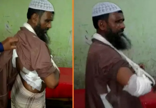 মামলায় হেরে গিয়ে মসজিদের ইমামের উপর হামলা