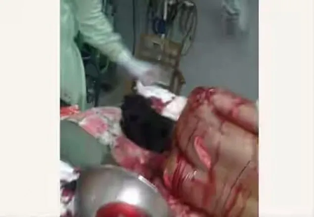 চট্রগ্রামে ছাত্রলীগ নেতাকে কুপিয়ে জখম